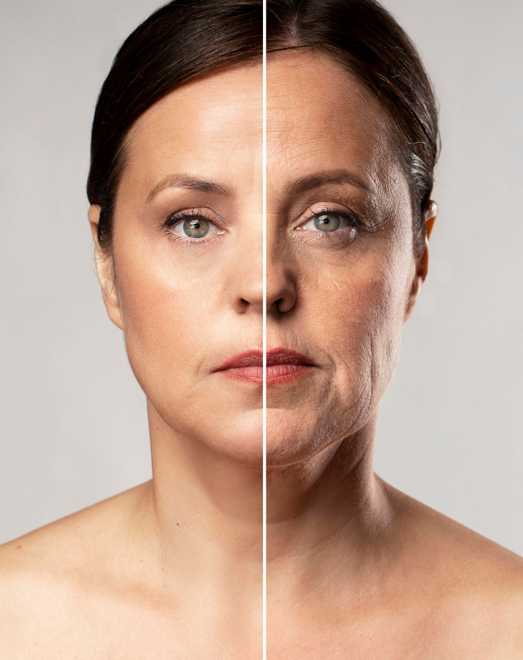 Anti-Aging Treatment