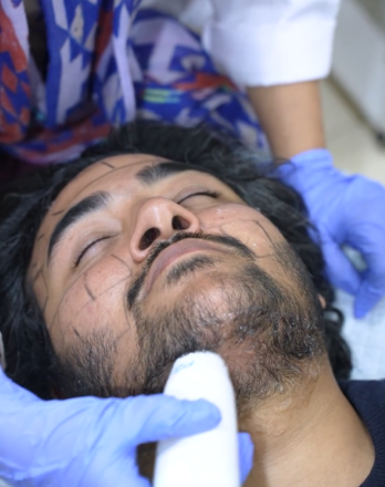 Double Chin Treatment